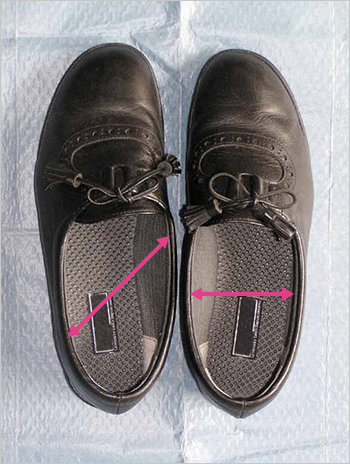 図：靴の変形とその原因