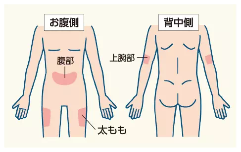 イメージ図：お腹側（腹部・太もも）、背中側（上腕部）